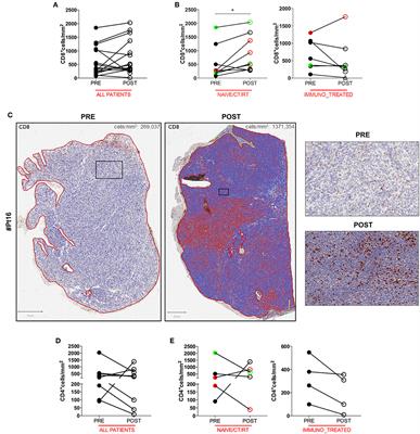 Dendritic Cell Vaccination in Metastatic Melanoma Turns “Non-T Cell Inflamed” Into “T-Cell Inflamed” Tumors